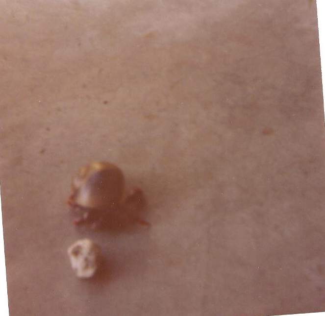 [hermit crab photos]